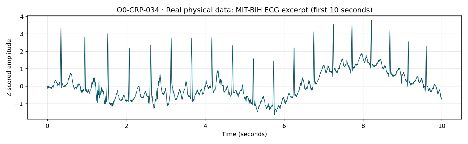 Figure from O0-CRP-034: 01 ecg signal excerpt